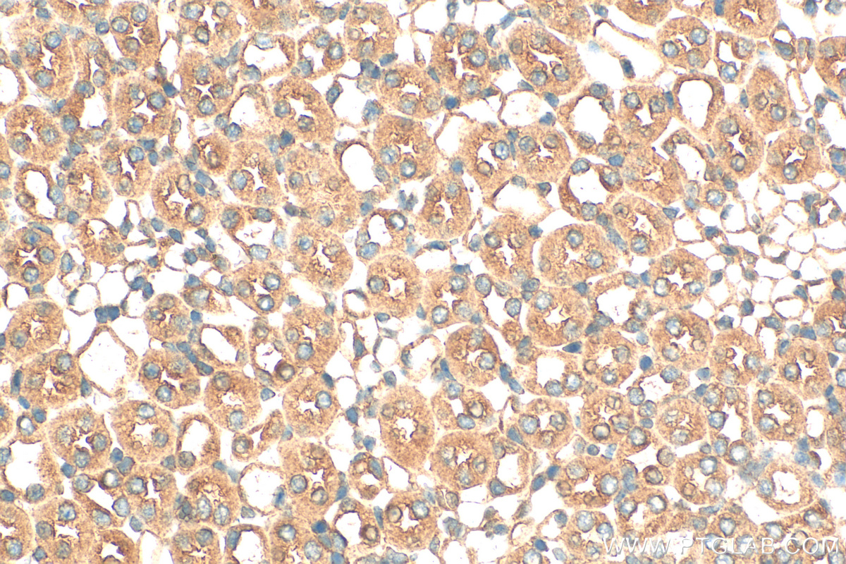 Immunohistochemistry (IHC) staining of mouse kidney tissue using RABL2B Polyclonal antibody (11588-1-AP)