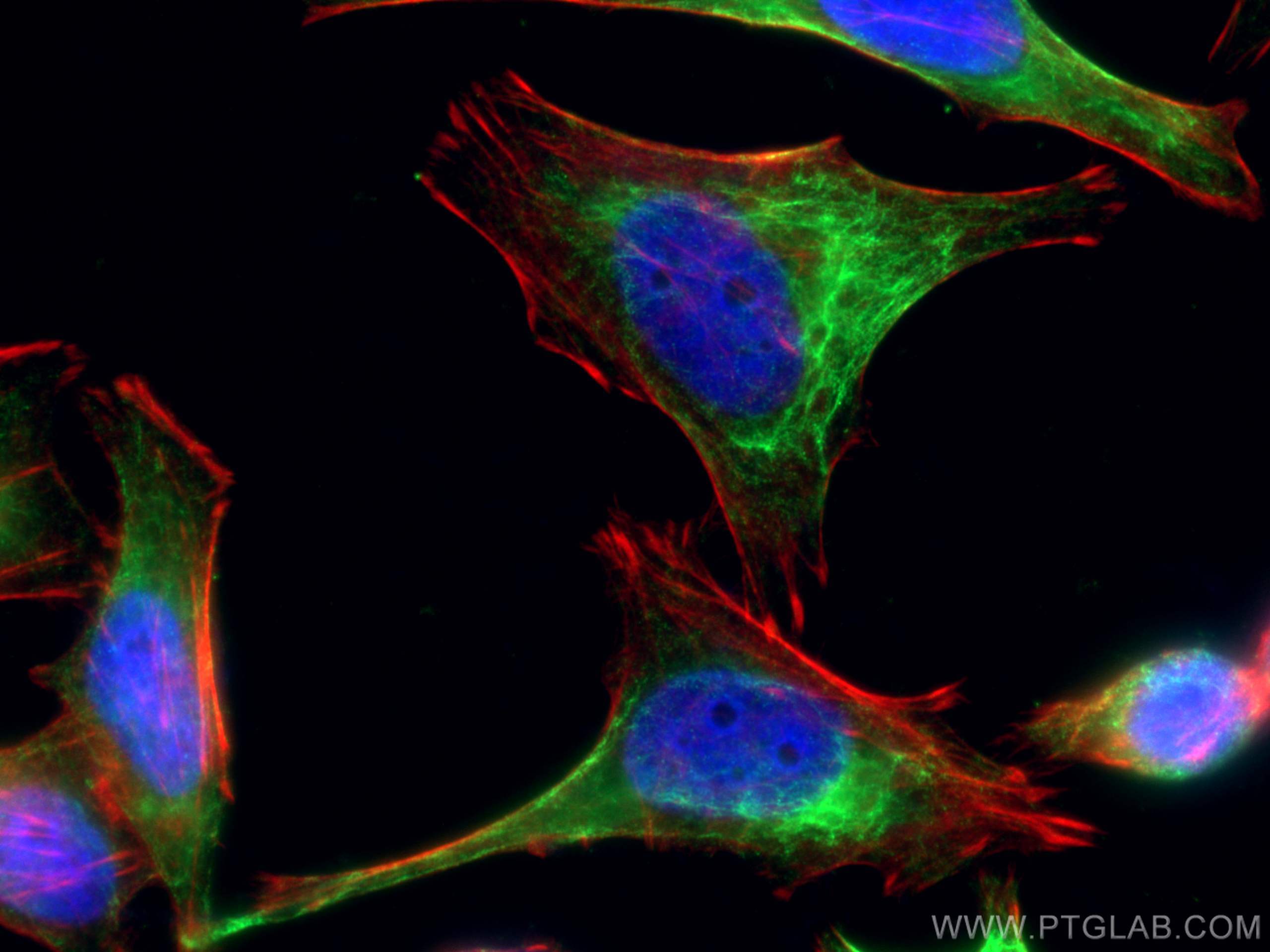 Immunofluorescence (IF) / fluorescent staining of HeLa cells using Rac1 Polyclonal antibody (24072-1-AP)