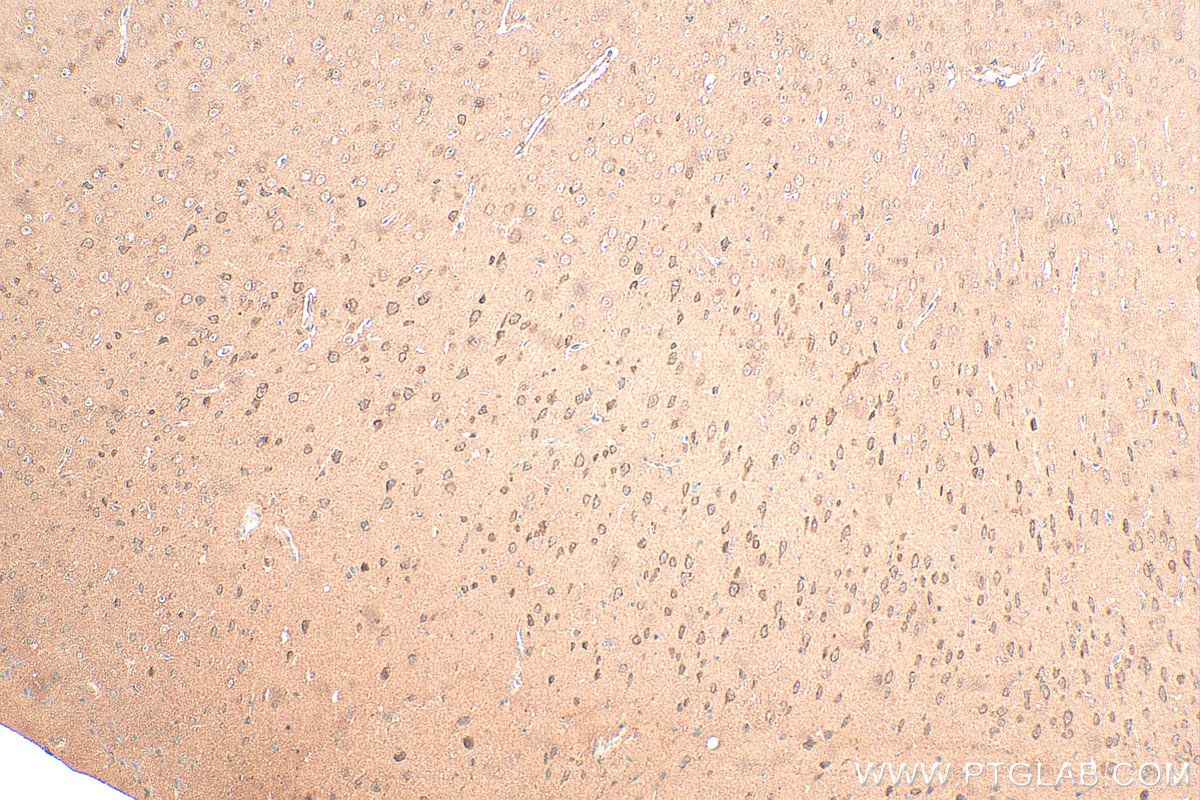 Immunohistochemistry (IHC) staining of mouse brain tissue using Rac1 Polyclonal antibody (24072-1-AP)