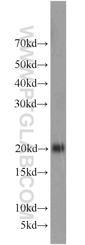 最大41%OFFクーポン アズワン 1-5366-17 分光光度計プログラムパックDNA 蛋白質 1536617