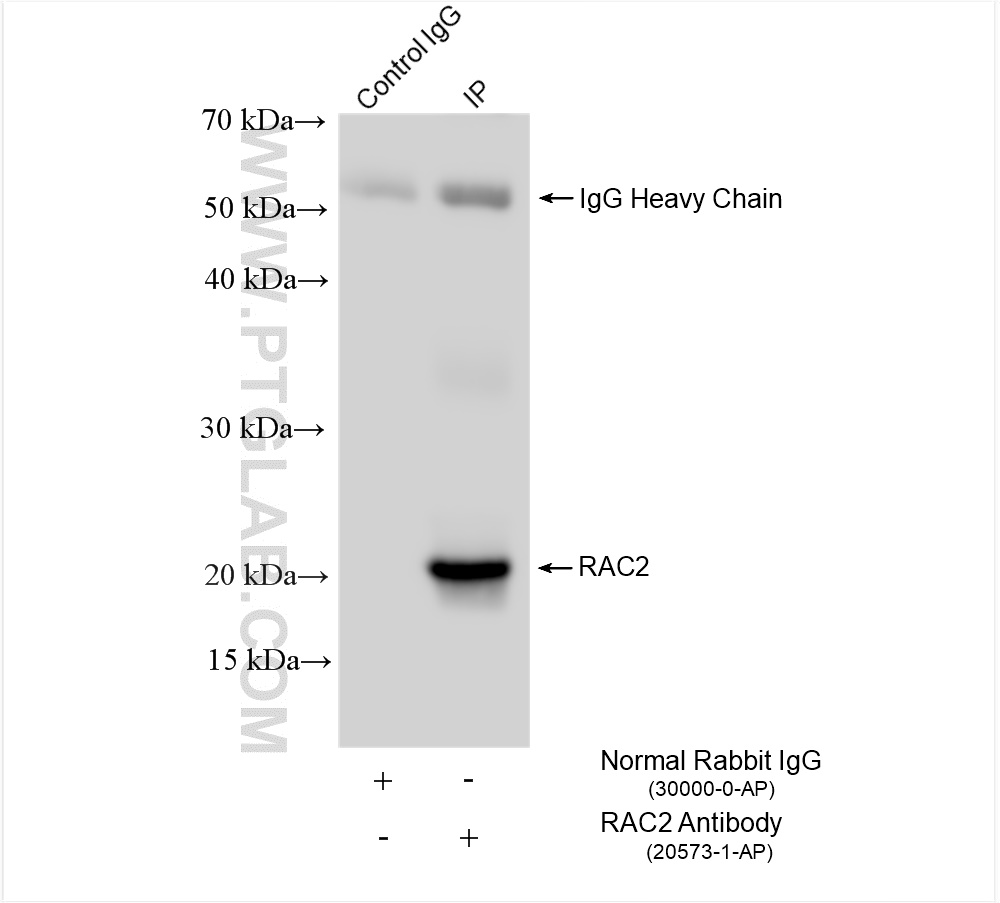 Immunoprecipitation (IP) experiment of MOLT-4 cells using RAC2 Polyclonal antibody (20573-1-AP)