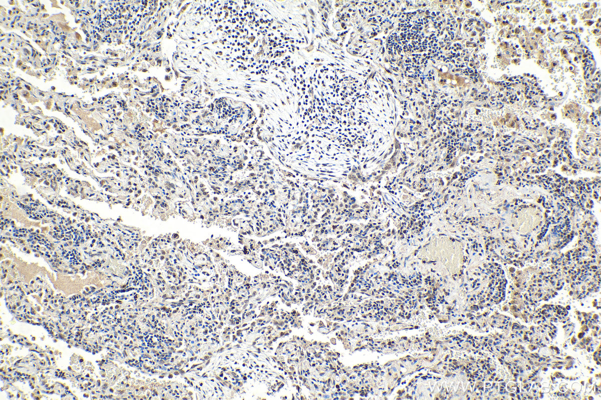 Immunohistochemistry (IHC) staining of human lung tissue using RAD1 Polyclonal antibody (11726-2-AP)