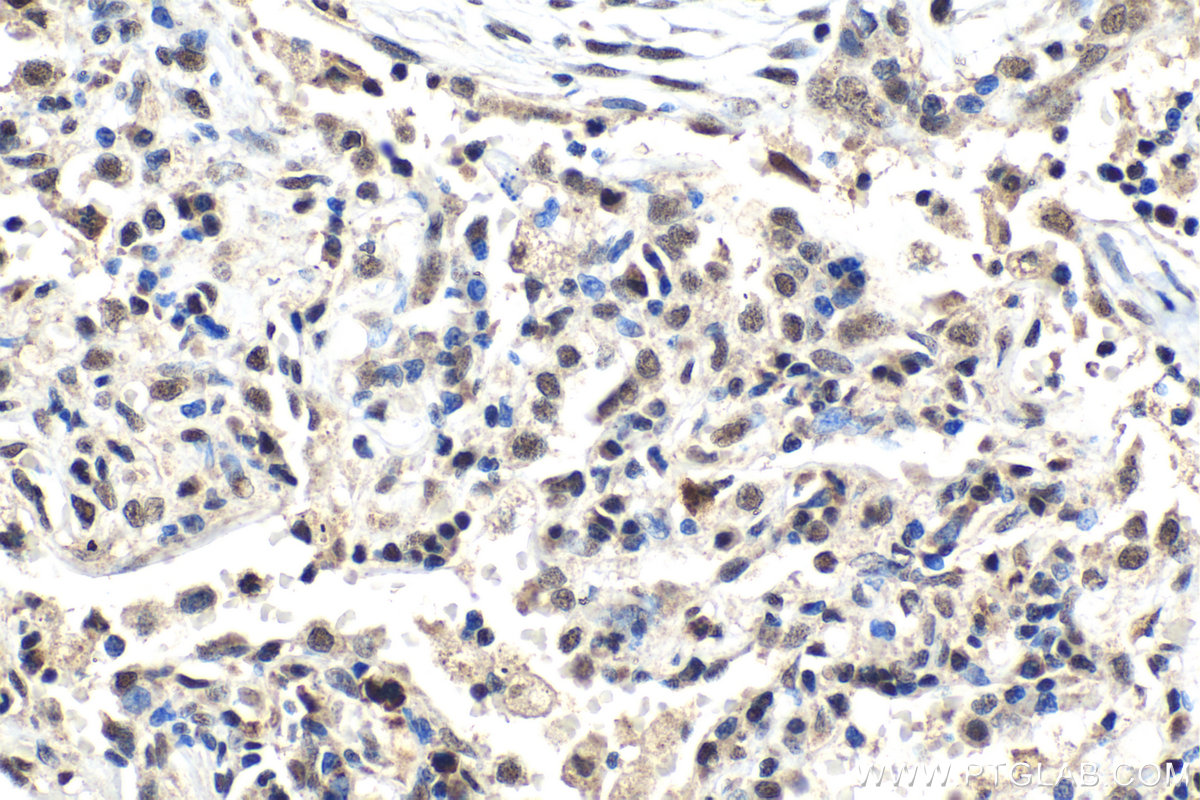 Immunohistochemistry (IHC) staining of human lung tissue using RAD1 Polyclonal antibody (11726-2-AP)