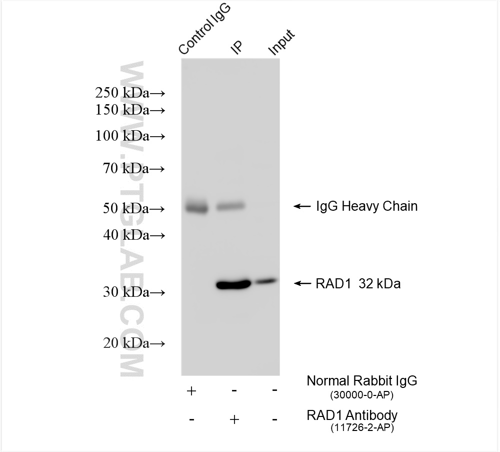 Immunoprecipitation (IP) experiment of HeLa cells using RAD1 Polyclonal antibody (11726-2-AP)