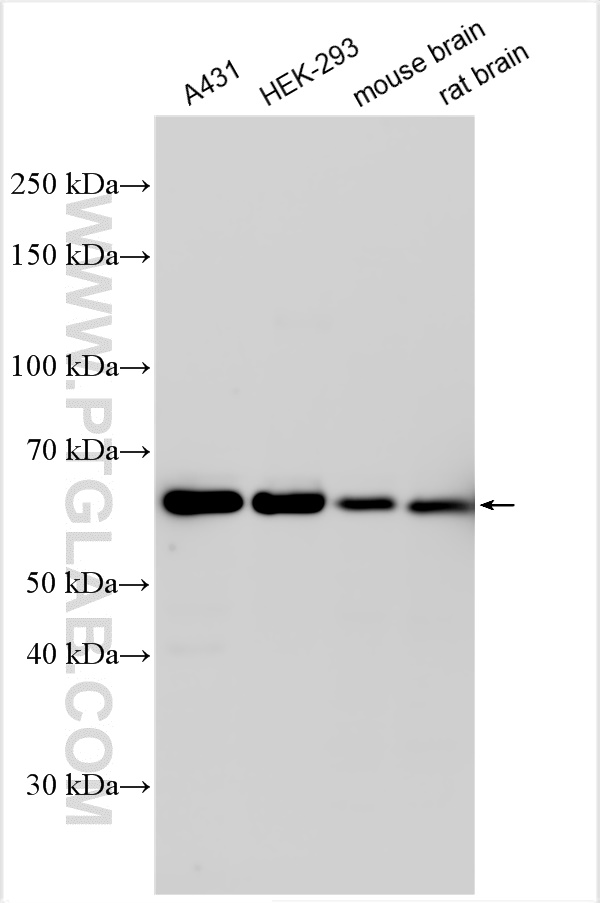 Western Blot (WB) analysis of various lysates using RAD23B Polyclonal antibody (12121-1-AP)