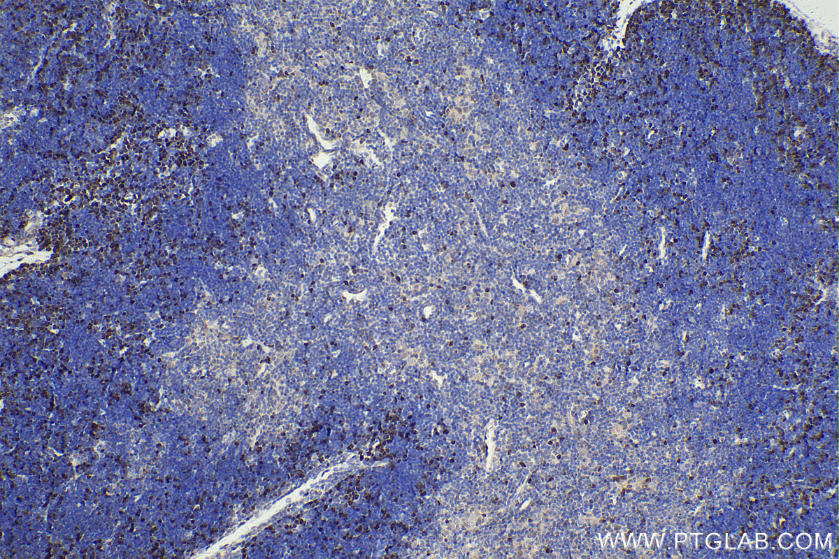 Immunohistochemistry (IHC) staining of mouse thymus tissue using RAD51 Polyclonal antibody (14961-1-AP)