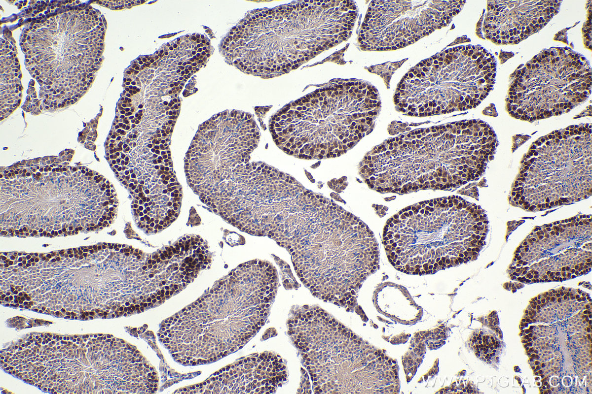 Immunohistochemistry (IHC) staining of mouse testis tissue using RAD51 Monoclonal antibody (67024-1-Ig)
