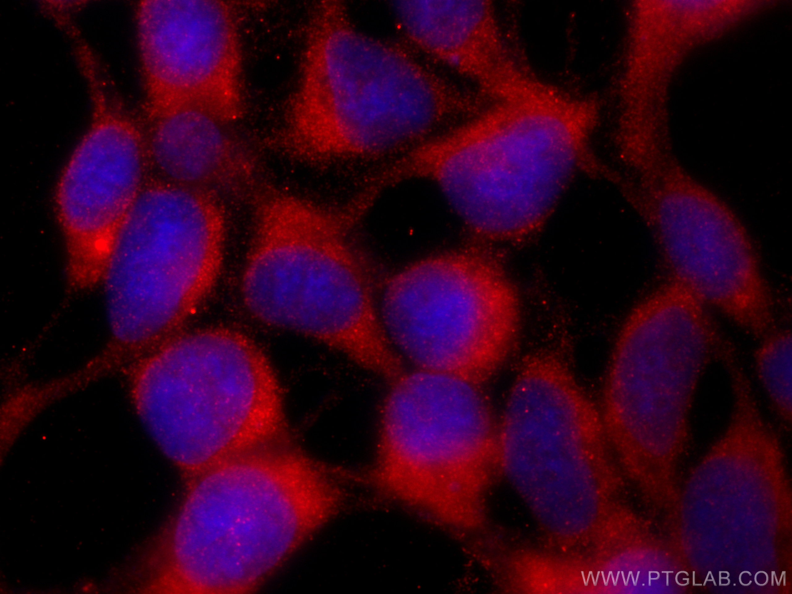 Immunofluorescence (IF) / fluorescent staining of HEK-293 cells using RAF1 Monoclonal antibody (66592-1-Ig)