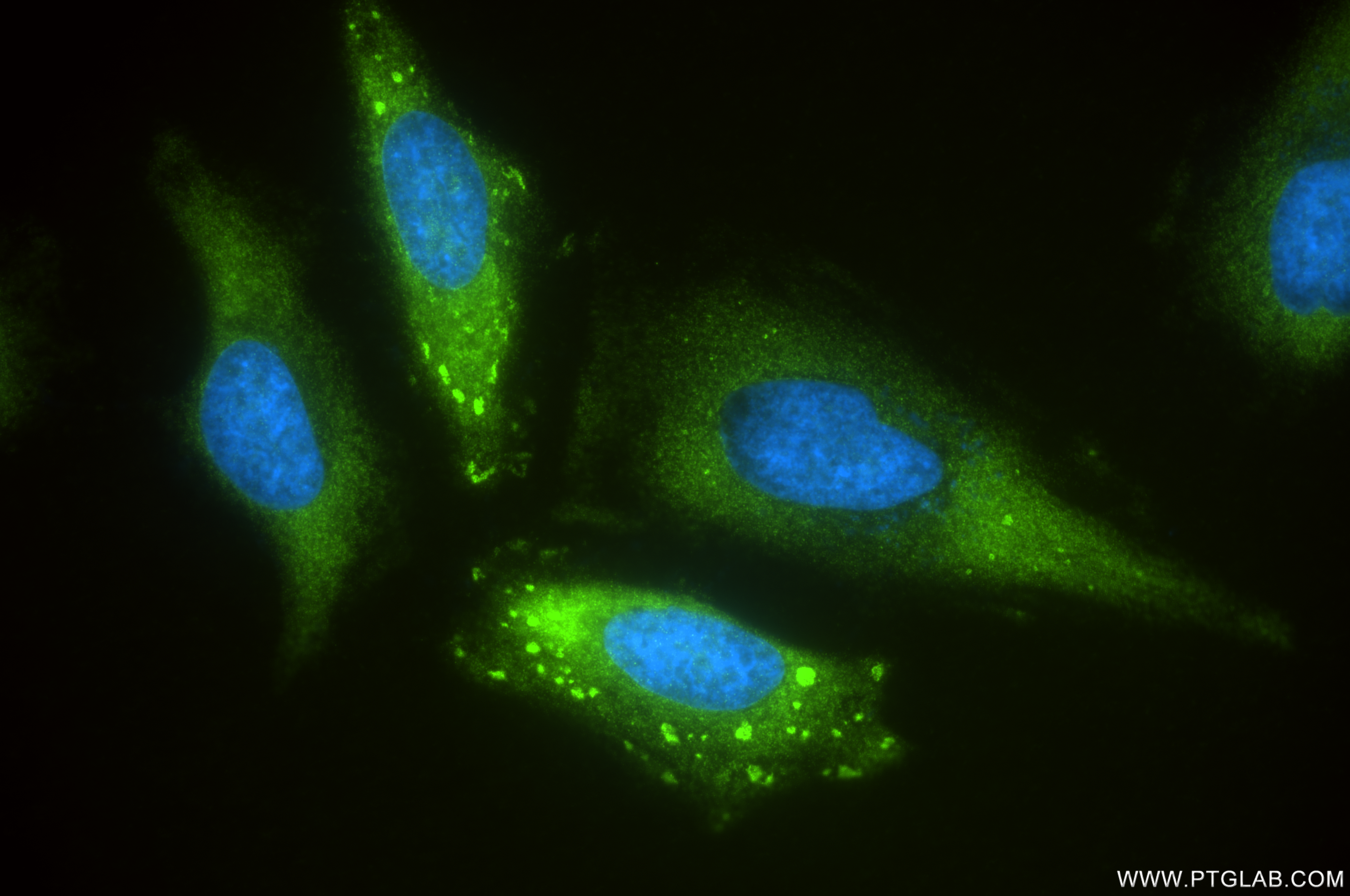 Immunofluorescence (IF) / fluorescent staining of HeLa cells using RAF1 Recombinant antibody (84994-4-RR)