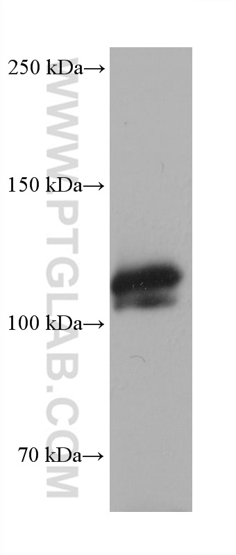 Western Blot (WB) analysis of various lysates using RAG1 Monoclonal antibody (68591-1-Ig)