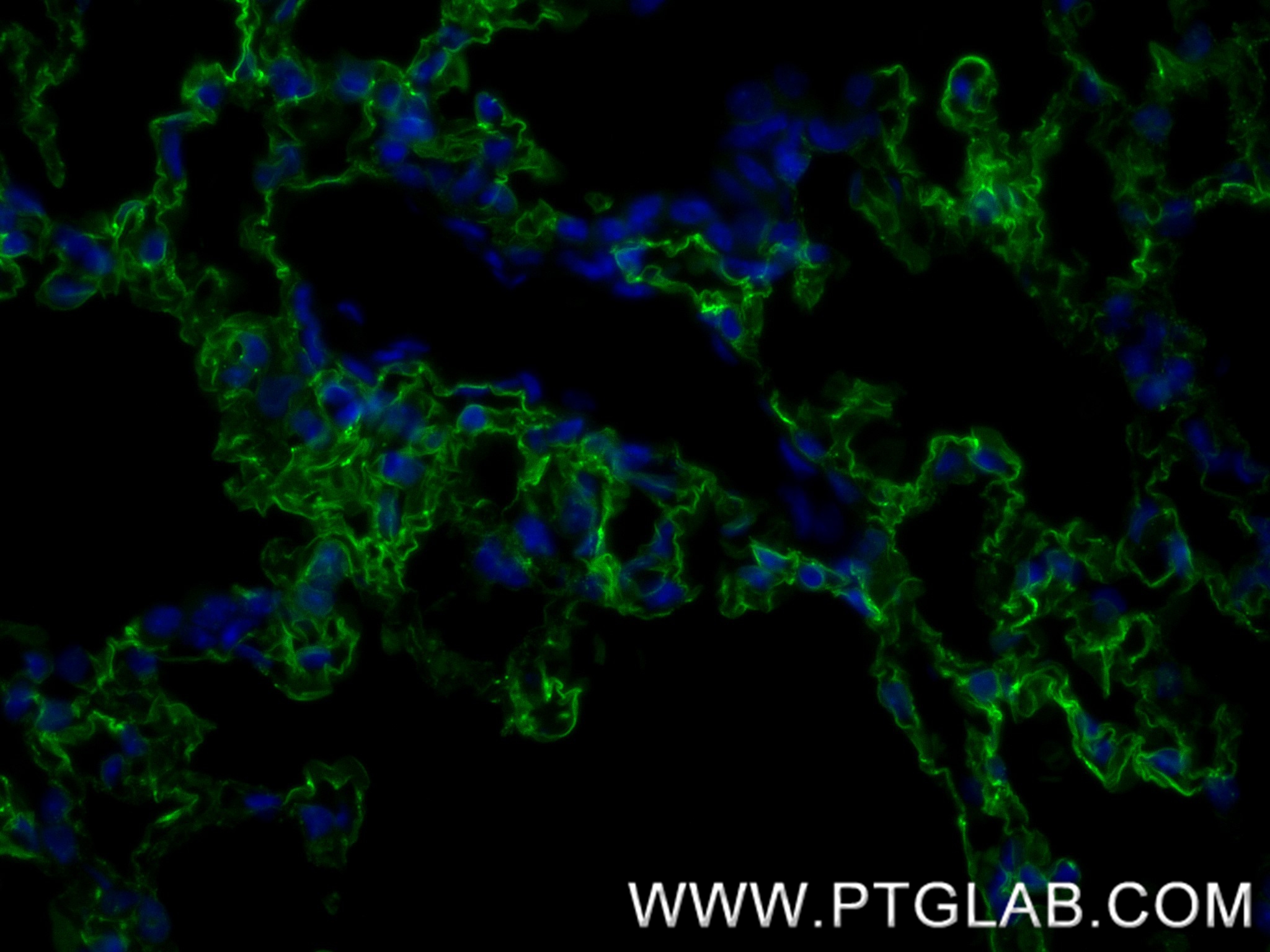 Immunofluorescence (IF) / fluorescent staining of mouse lung tissue using RAGE Recombinant antibody (83742-5-RR)