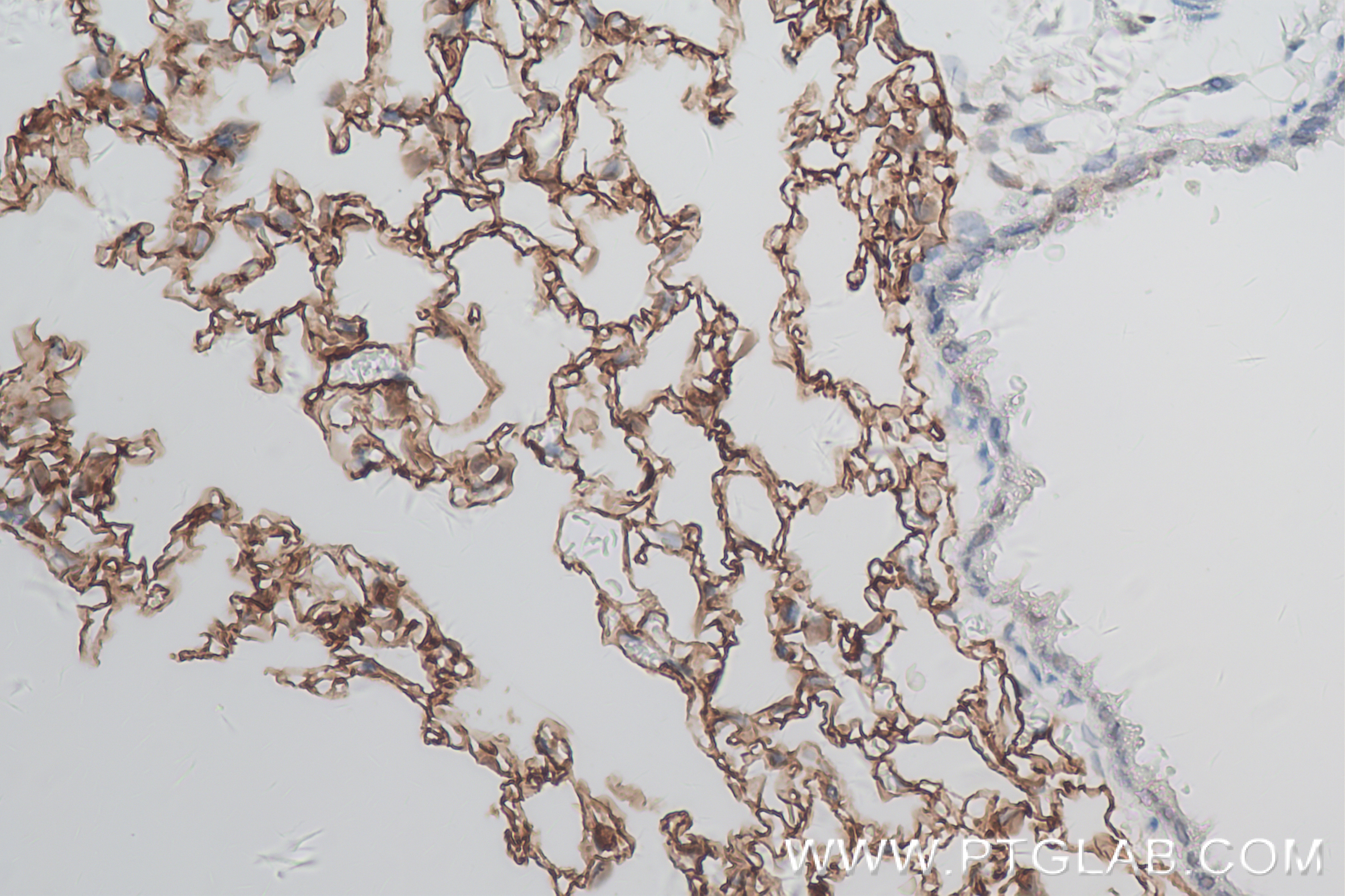 Immunohistochemistry (IHC) staining of mouse lung tissue using Ager/Rage Recombinant antibody (83742-5-RR)