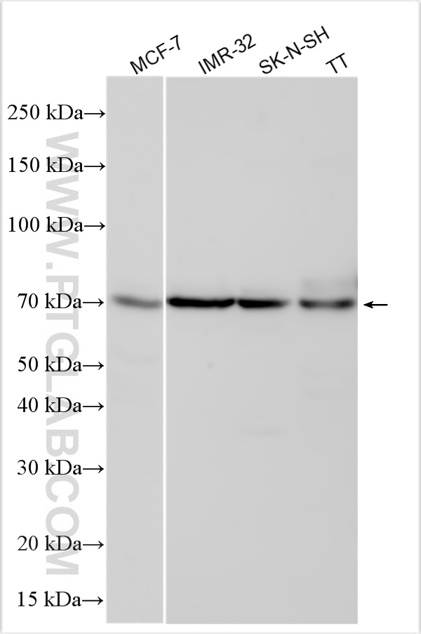 Western Blot (WB) analysis of various lysates using RAI2 Polyclonal antibody (28217-1-AP)