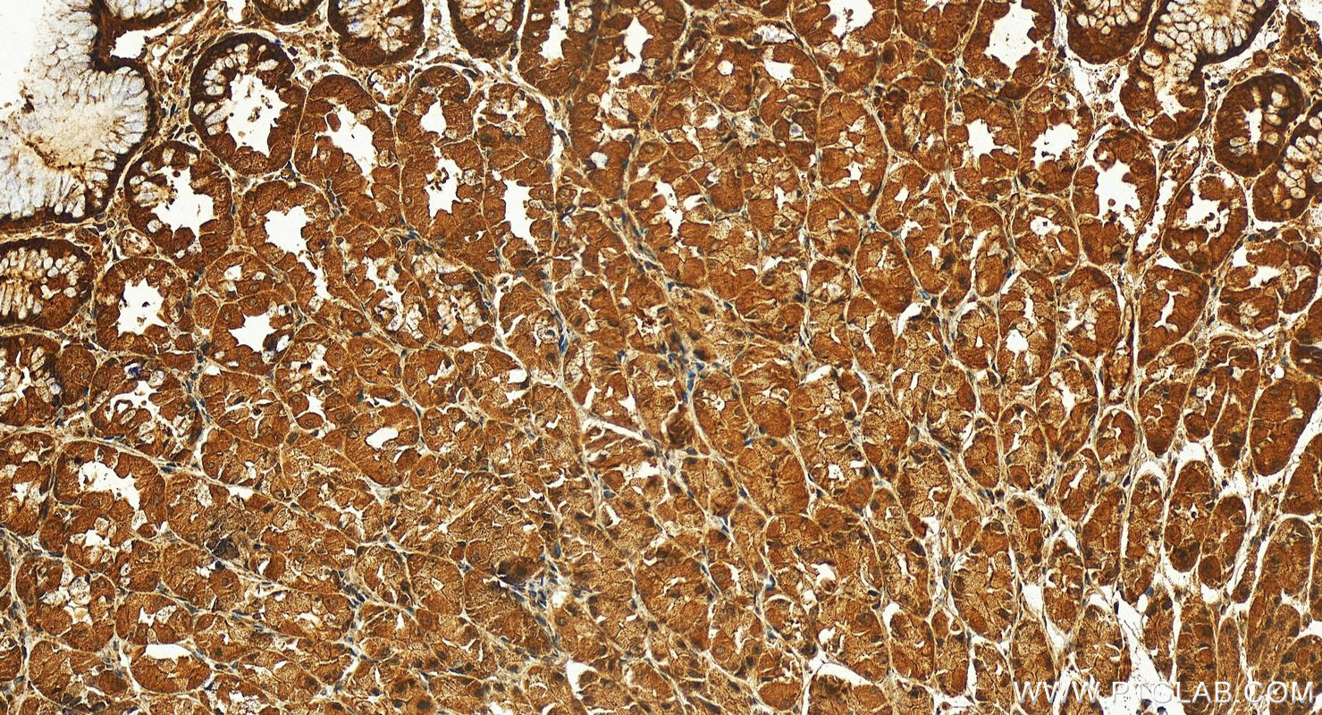 Immunohistochemistry (IHC) staining of human stomach tissue using RALBP1 Polyclonal antibody (13176-1-AP)