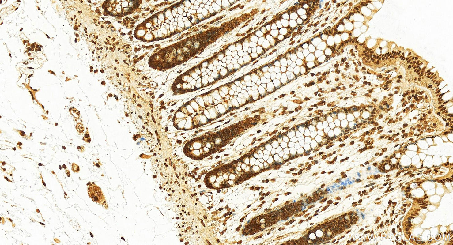 Immunohistochemistry (IHC) staining of human colon tissue using RAN Polyclonal antibody (10469-1-AP)