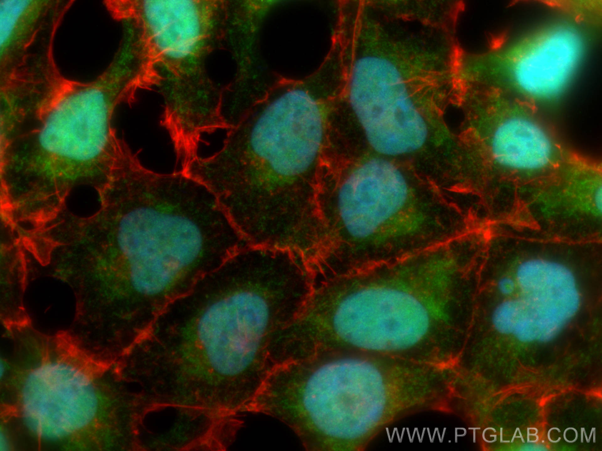 Immunofluorescence (IF) / fluorescent staining of HEK-293 cells using RAN Polyclonal antibody (10469-1-AP)