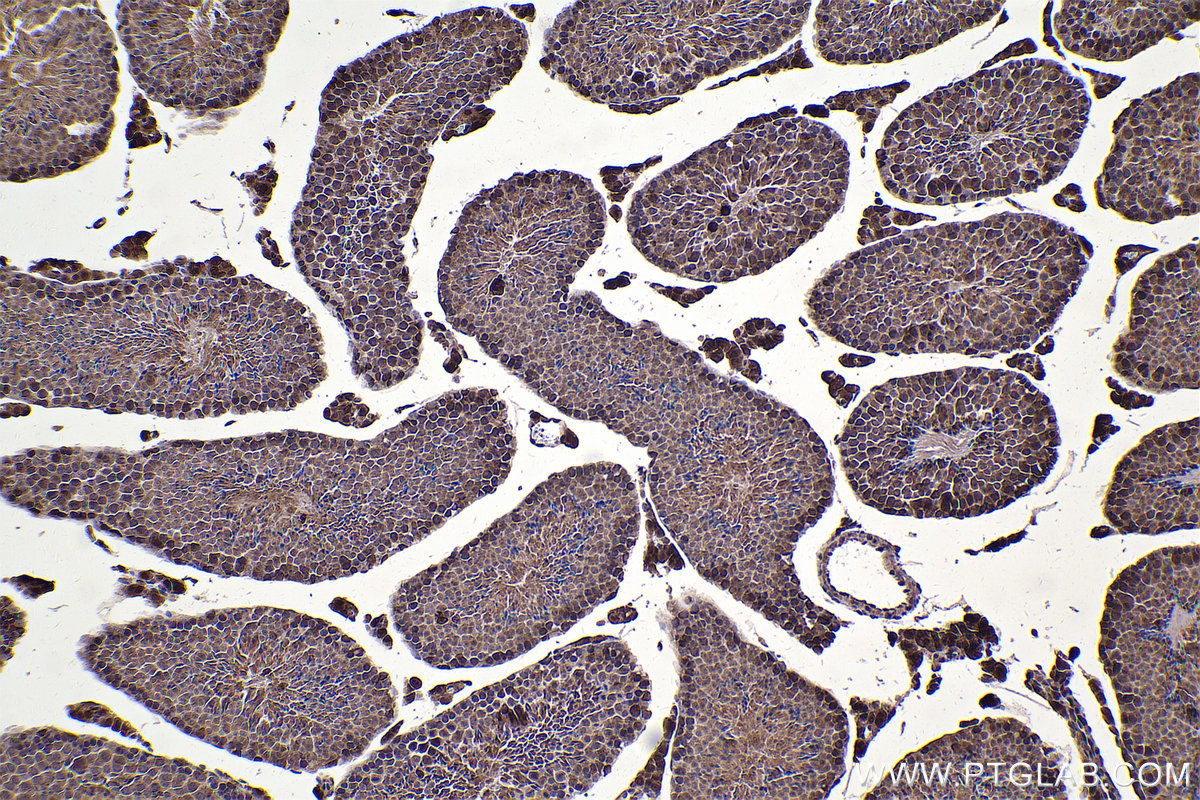 Immunohistochemistry (IHC) staining of mouse testis tissue using RAN Polyclonal antibody (10469-1-AP)