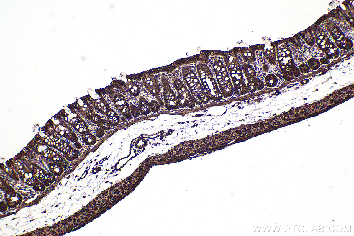 Immunohistochemistry (IHC) staining of rat colon tissue using RAN Polyclonal antibody (10469-1-AP)