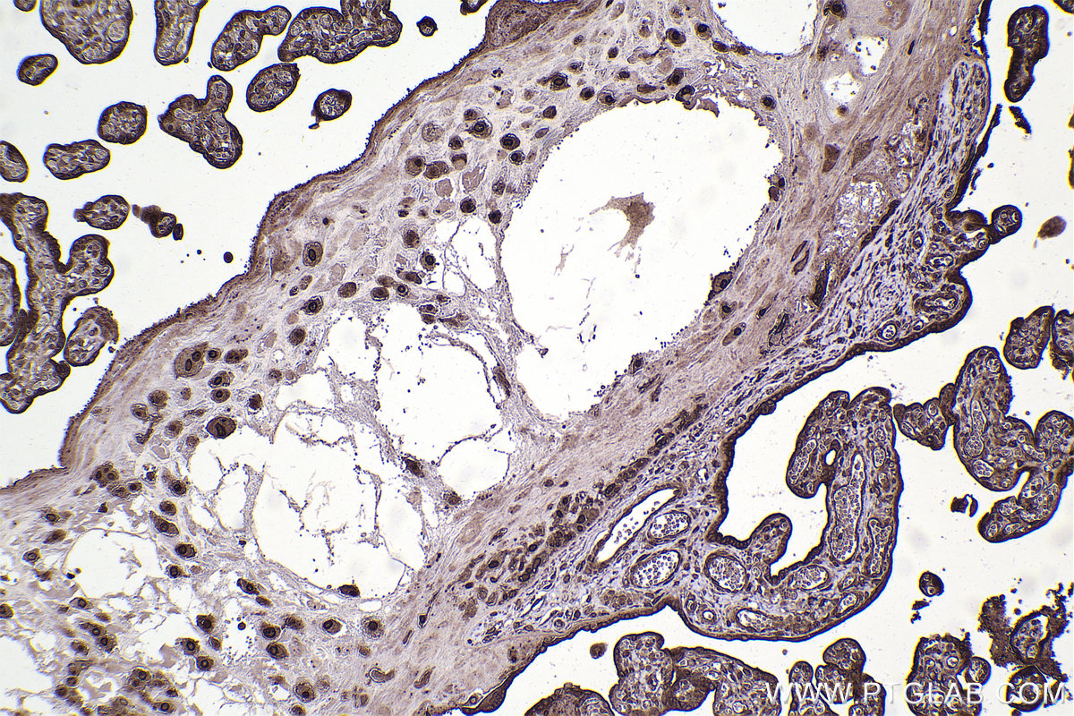 Immunohistochemistry (IHC) staining of human placenta tissue using RAN Polyclonal antibody (10469-1-AP)