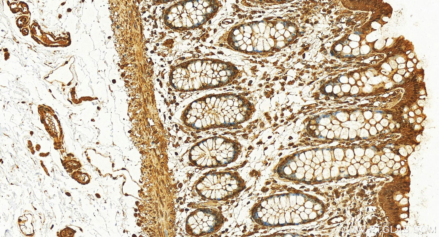 Immunohistochemistry (IHC) staining of human colon tissue using RAN Recombinant antibody (82978-1-RR)