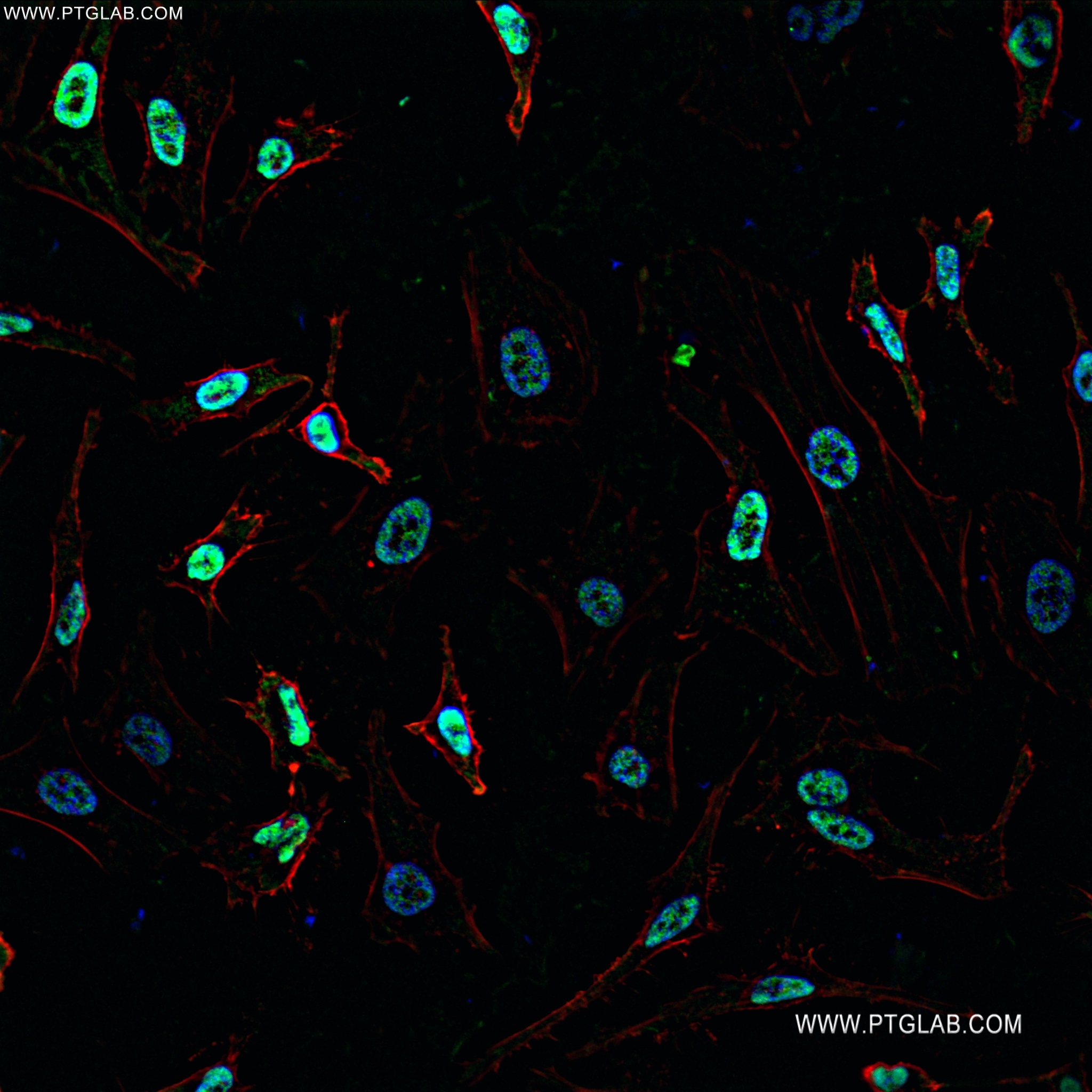 Immunofluorescence (IF) / fluorescent staining of HeLa cells using RAN Recombinant antibody (82978-1-RR)