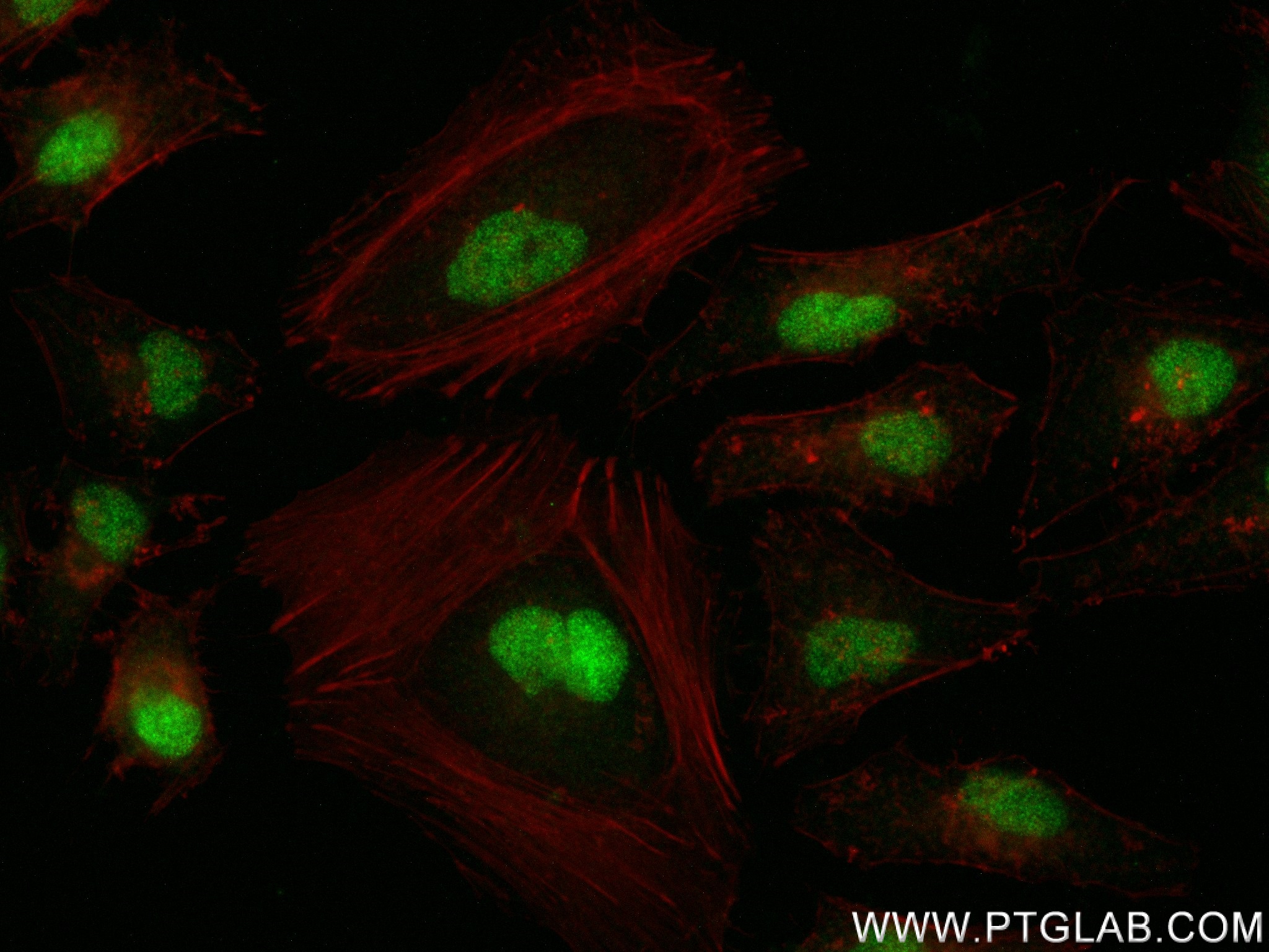 Immunofluorescence (IF) / fluorescent staining of HeLa cells using RAN Recombinant antibody (82978-1-RR)