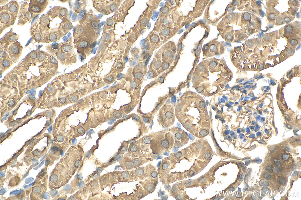 Immunohistochemistry (IHC) staining of mouse kidney tissue using RAN Recombinant antibody (82978-1-RR)