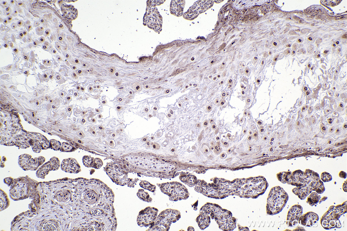 Immunohistochemistry (IHC) staining of human placenta tissue using RAN Recombinant antibody (82978-1-RR)