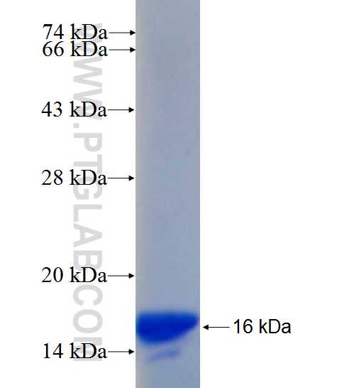 RANBP2 fusion protein Ag26435 SDS-PAGE