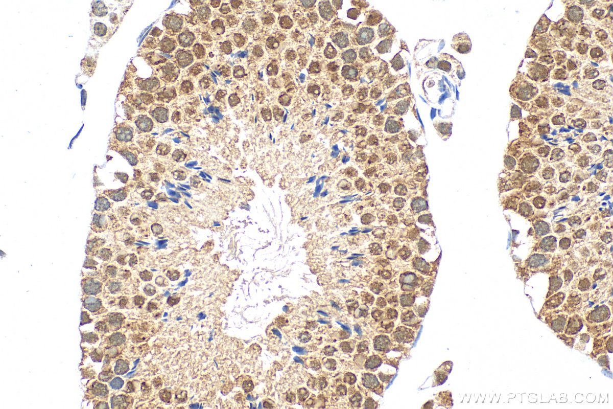 Immunohistochemistry (IHC) staining of mouse testis tissue using RANBP3 Polyclonal antibody (27168-1-AP)