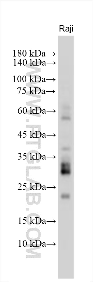 Western Blot (WB) analysis of various lysates using RANKL Polyclonal antibody (23408-1-AP)