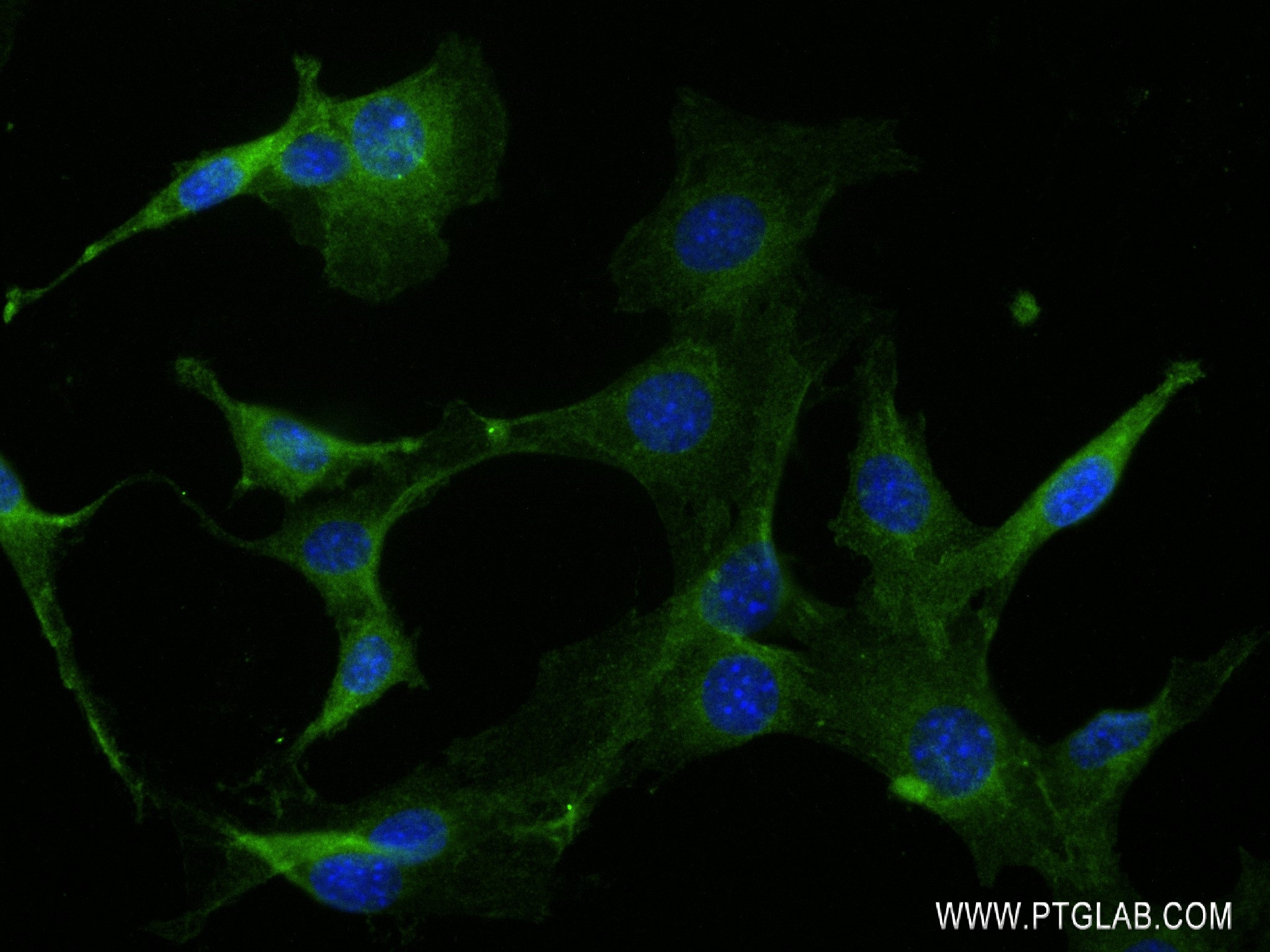 Immunofluorescence (IF) / fluorescent staining of NIH/3T3 cells using RAP1A Recombinant antibody (83708-1-RR)