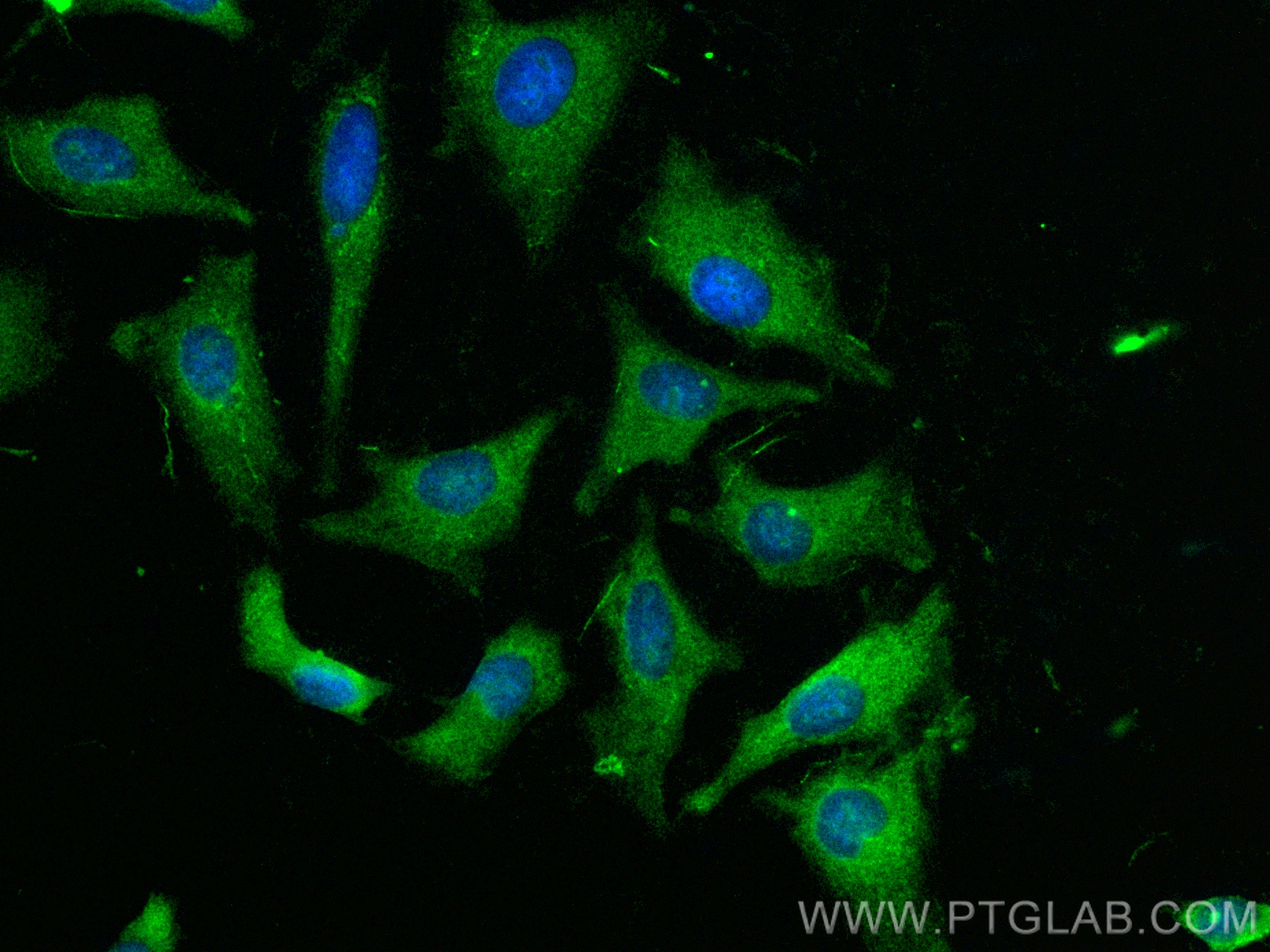 Immunofluorescence (IF) / fluorescent staining of HeLa cells using CoraLite® Plus 488-conjugated RAP1GAP Polyclonal a (CL488-19174)