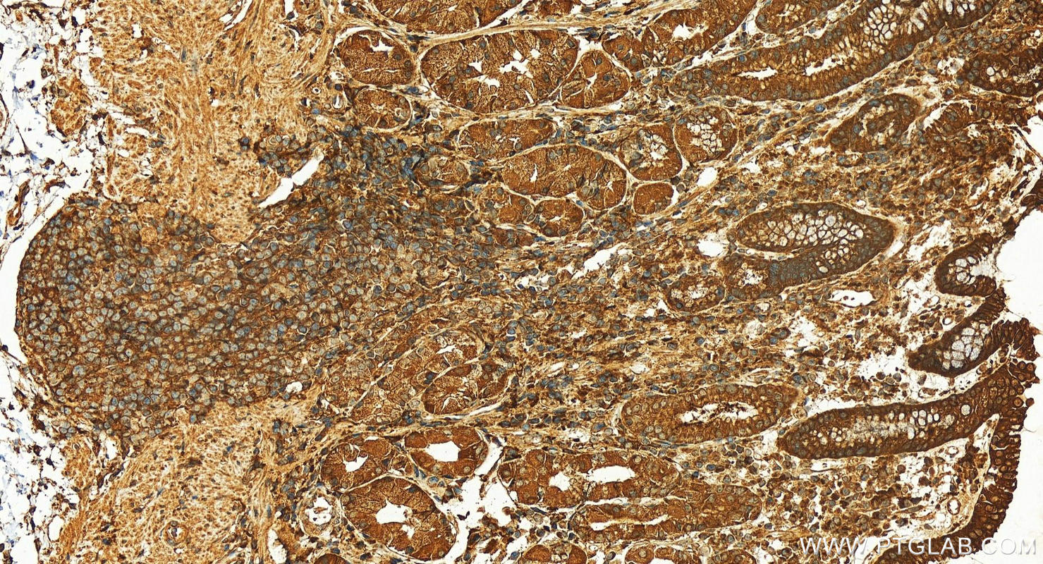 Immunohistochemistry (IHC) staining of human stomach tissue using RAP2B Polyclonal antibody (16266-1-AP)