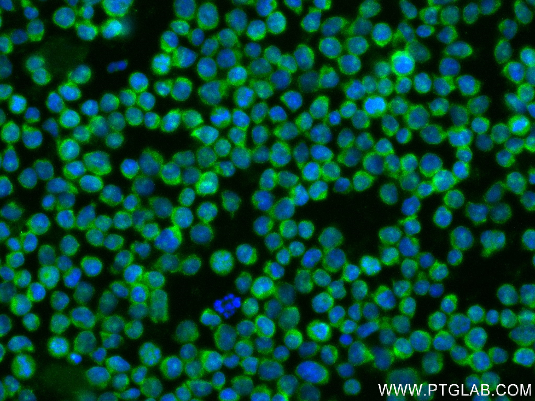 Immunofluorescence (IF) / fluorescent staining of Jurkat cells using RAPGEF2 Recombinant antibody (84331-4-RR)