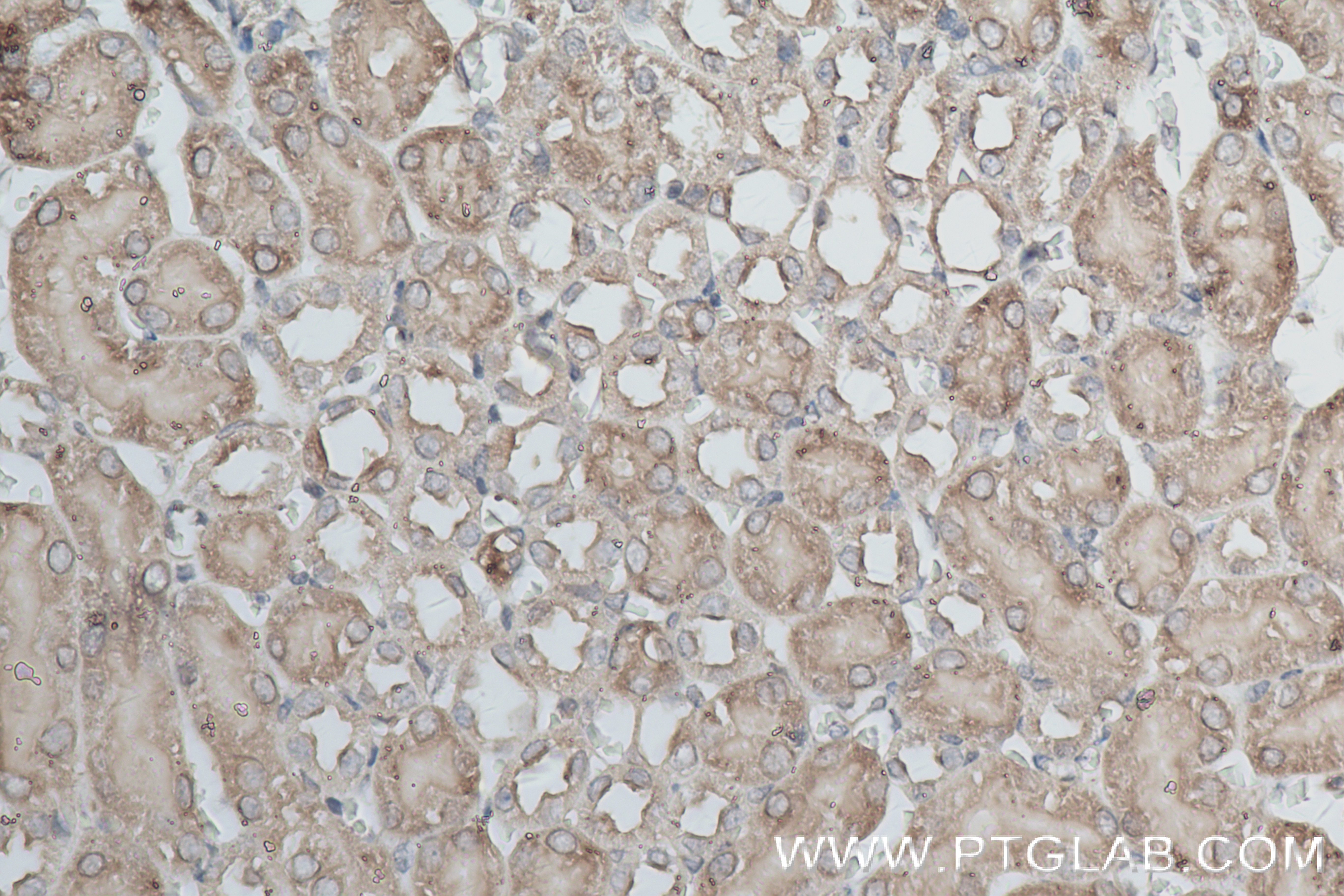 Immunohistochemistry (IHC) staining of mouse kidney tissue using RAPGEF2 Recombinant antibody (84331-4-RR)