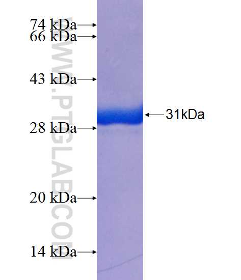 RARA fusion protein Ag25079 SDS-PAGE