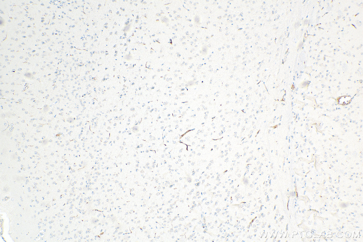 Immunohistochemistry (IHC) staining of mouse brain tissue using RARS Monoclonal antibody (66815-1-Ig)