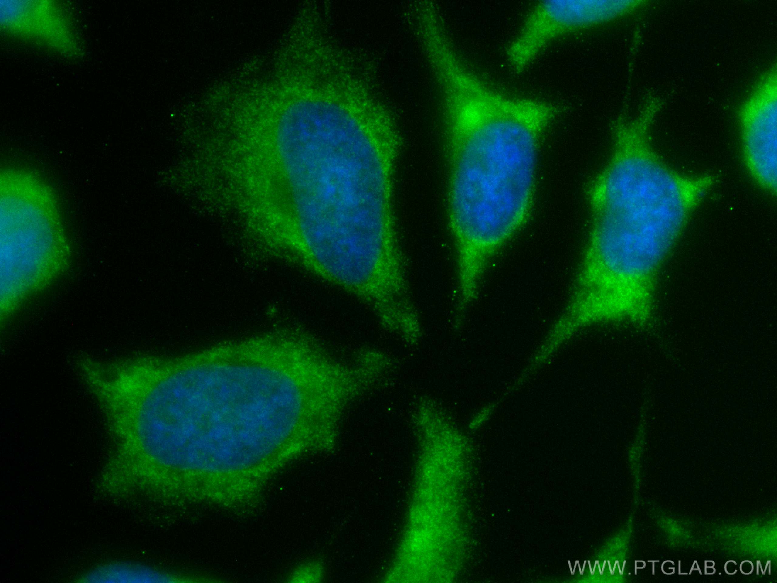 Immunofluorescence (IF) / fluorescent staining of HeLa cells using CoraLite® Plus 488-conjugated RARS Monoclonal anti (CL488-66815)