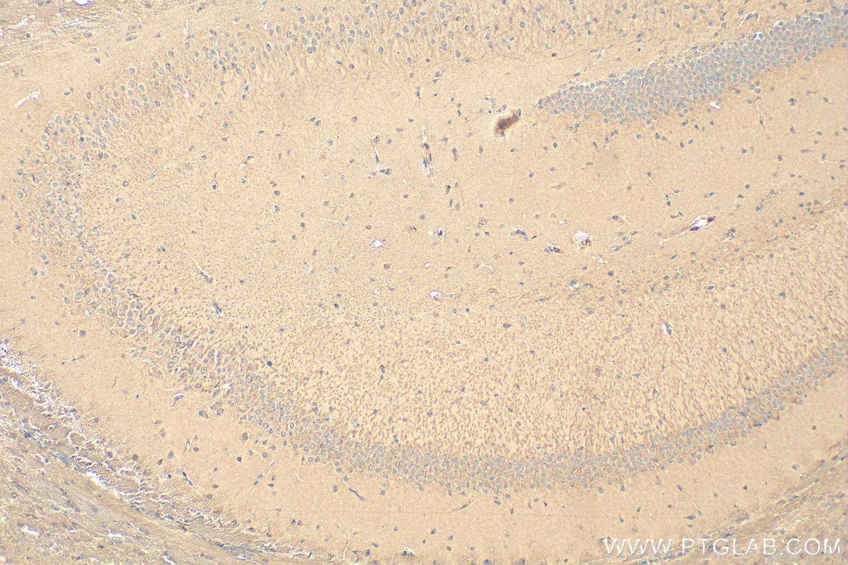 Immunohistochemistry (IHC) staining of mouse brain tissue using RASEF Polyclonal antibody (11569-1-AP)