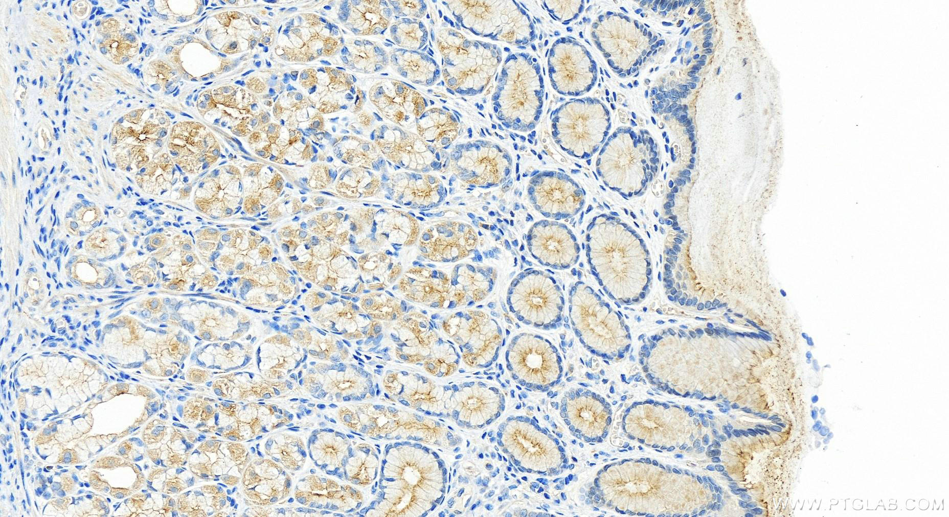 Immunohistochemistry (IHC) staining of human stomach tissue using RASEF Polyclonal antibody (28162-1-AP)