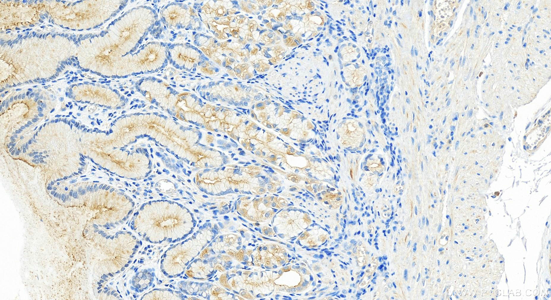 Immunohistochemistry (IHC) staining of human stomach tissue using RASEF Polyclonal antibody (28162-1-AP)