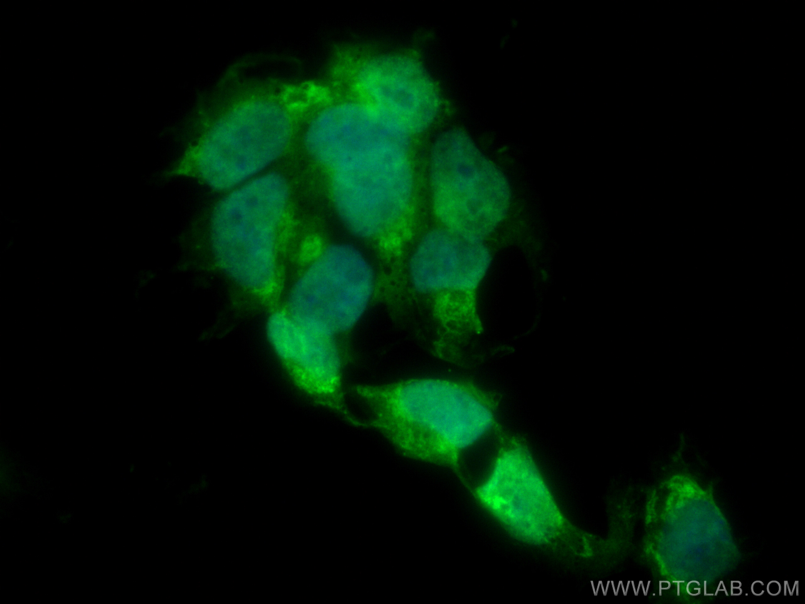 Immunofluorescence (IF) / fluorescent staining of SH-SY5Y cells using CoraLite® Plus 488-conjugated RB1 Monoclonal antib (CL488-67521)