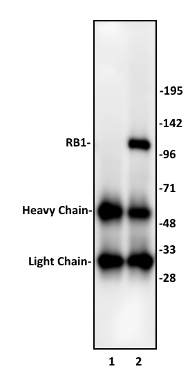 RB1 antibody (pAb) tested by Immunoprecipitation. 10 ul of RB1 antibody was used to immunoprecipitate RB1 from 250 ug of Jurkat nuclear cell extract (lane 2). 10 ul of rabbit IgG was used as a negative control (lane 1). The immunoprecipitated protein was detected by Western blotting using the RB1 antibody at a dilution of 1:500.
