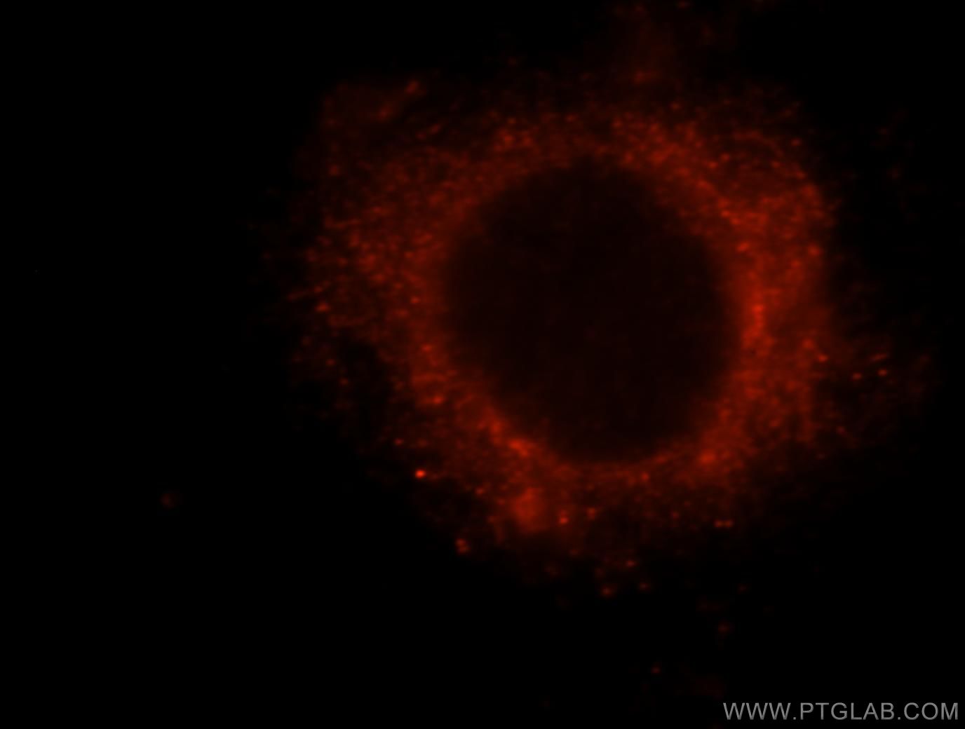 Immunofluorescence (IF) / fluorescent staining of HeLa cells using RB1CC1 Polyclonal antibody (10043-2-AP)
