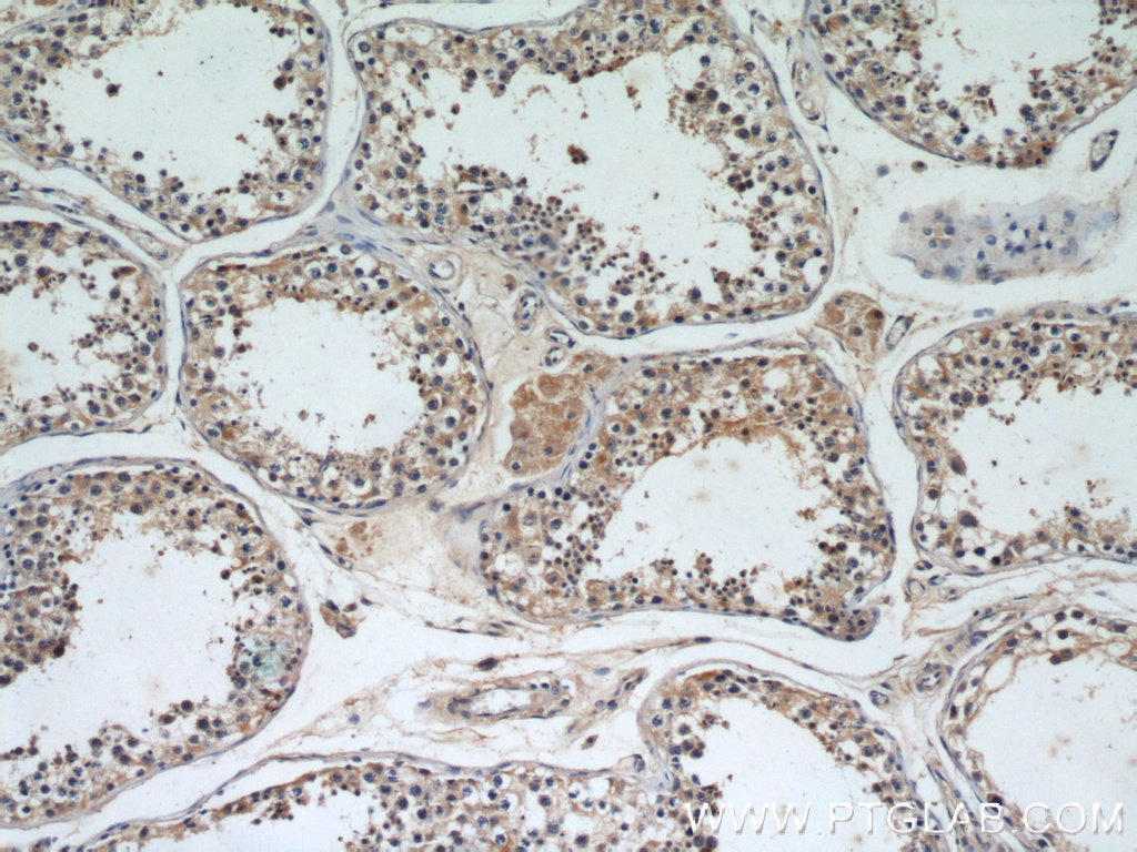 Immunohistochemistry (IHC) staining of human testis tissue using RB1CC1 Polyclonal antibody (10043-2-AP)