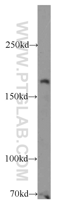 Western Blot (WB) analysis of HeLa cells using RB1CC1 Polyclonal antibody (10043-2-AP)