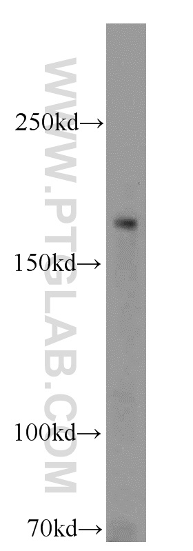 Western Blot (WB) analysis of HeLa cells using RB1CC1 Polyclonal antibody (10043-2-AP)