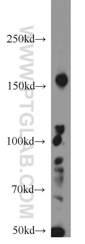 Western Blot (WB) analysis of Jurkat cells using RB1CC1 Polyclonal antibody (10043-2-AP)