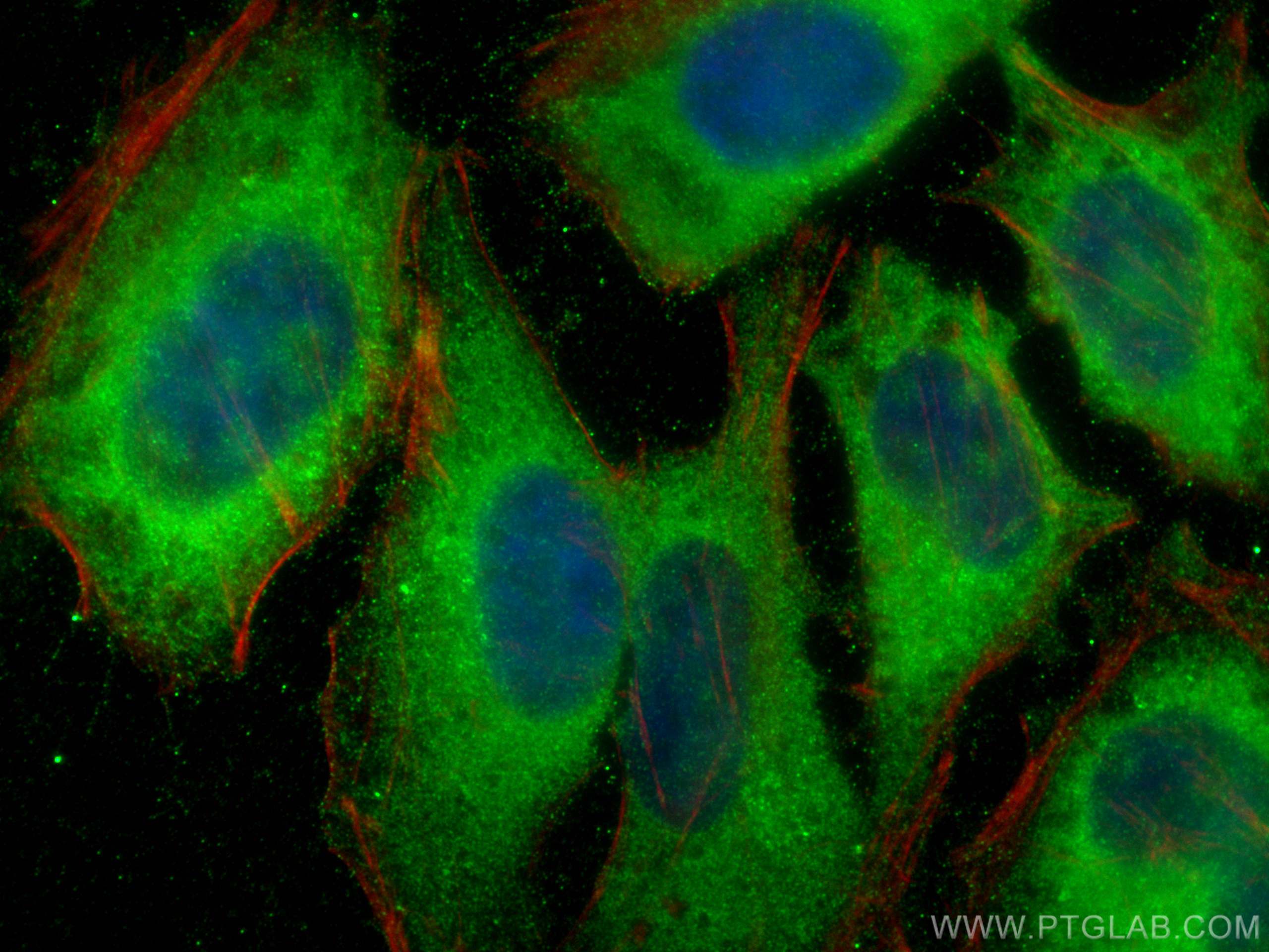 Immunofluorescence (IF) / fluorescent staining of HeLa cells using RB1CC1 Polyclonal antibody (10069-1-AP)